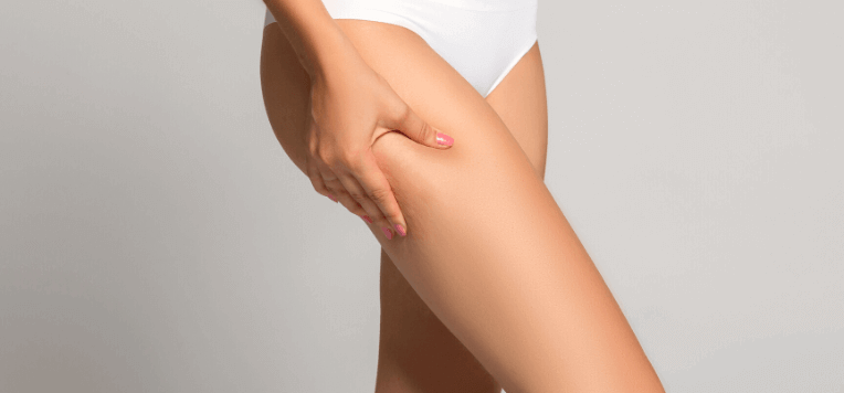 Cellulite e ritenzione idrica: cause e rimedi